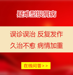 亳州银屑病医院疾病问答