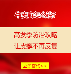 亳州银屑病医院医院资讯