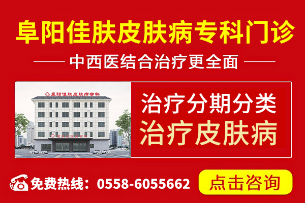 亳州银屑病医院