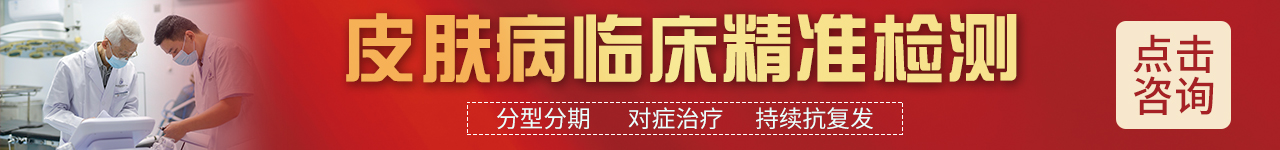 亳州银屑病医院在线问诊